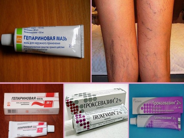 geparinovaya-maz-ili-troksevazin-chto-luchshe