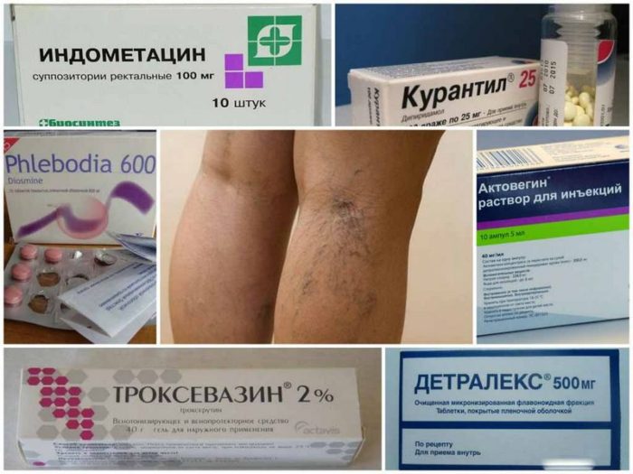 medicinskie-preparaty-ot-varikoza-ven